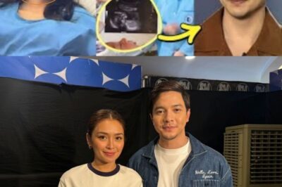 Shocking News! Is Alden Richards About to Become a Father? Direk Karthyn Reveals the Truth! (NH)